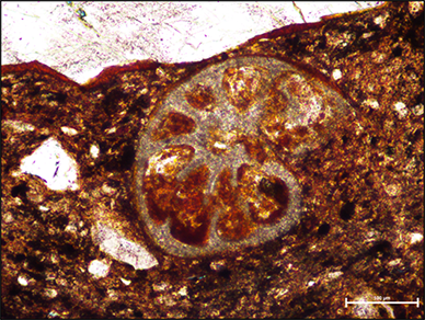 Mikrofossil im Dünnschliff