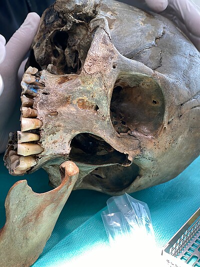Surgery in the dental office Schumann & Rolfsen